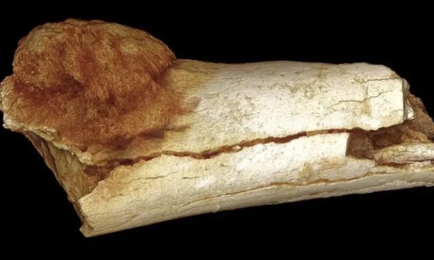 Fosil Purba Berusia 1,7 Juta Tahun Ungkap Manusia Pertama Yang Kena Kanker