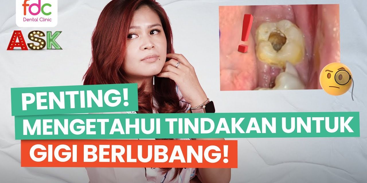 Perawatan Medis Untuk Gigi Berlubang, Yuk Kita Bahas Di Sini