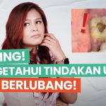 Perawatan Medis Untuk Gigi Berlubang, Yuk Kita Bahas Di Sini