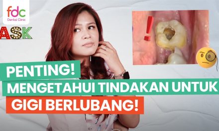 Perawatan Medis Untuk Gigi Berlubang, Yuk Kita Bahas Di Sini