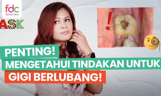 Perawatan Medis Untuk Gigi Berlubang, Yuk Kita Bahas Di Sini